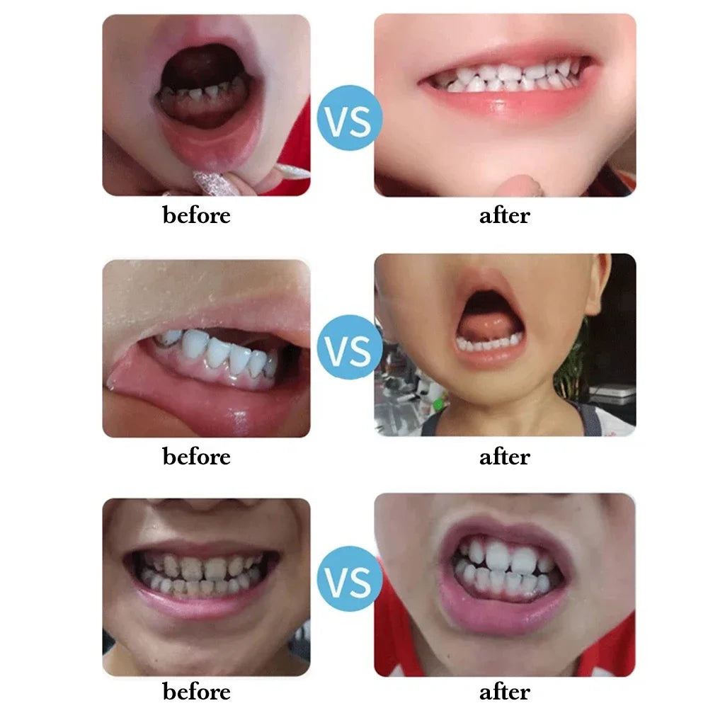 30PCS Whitening Tooth Cleaner Nano Sponge Head Wipe Tooth Cleaning Strips Oral Care Tartar Remover Teeth Cleaner Dental Tools