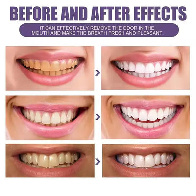Purple Whitening Teeth Stickers 14 Pairs Gel Whitening Strips Stain Removal Oral Hygiene Care Strip Dental Bleaching Tools Teeth