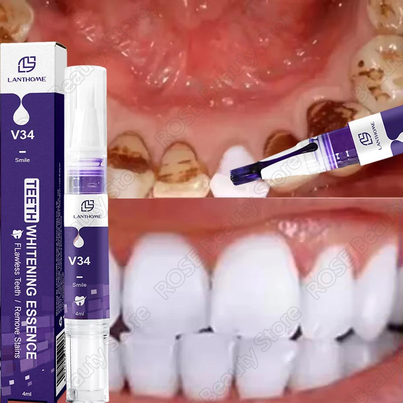 Purple Whitening Teeth Stickers 14 Pairs Gel Whitening Strips Stain Removal Oral Hygiene Care Strip Dental Bleaching Tools Teeth