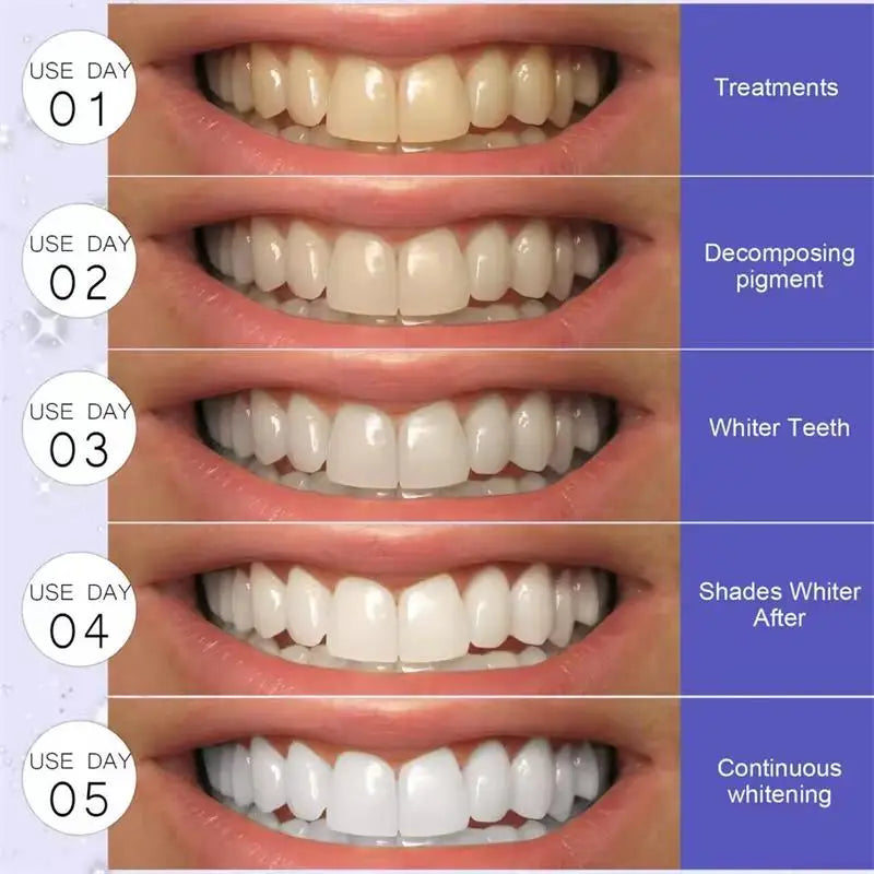 Purple Whitening Teeth Stickers 14 Pairs Gel Whitening Strips Stain Removal Oral Hygiene Care Strip Dental Bleaching Tools Teeth